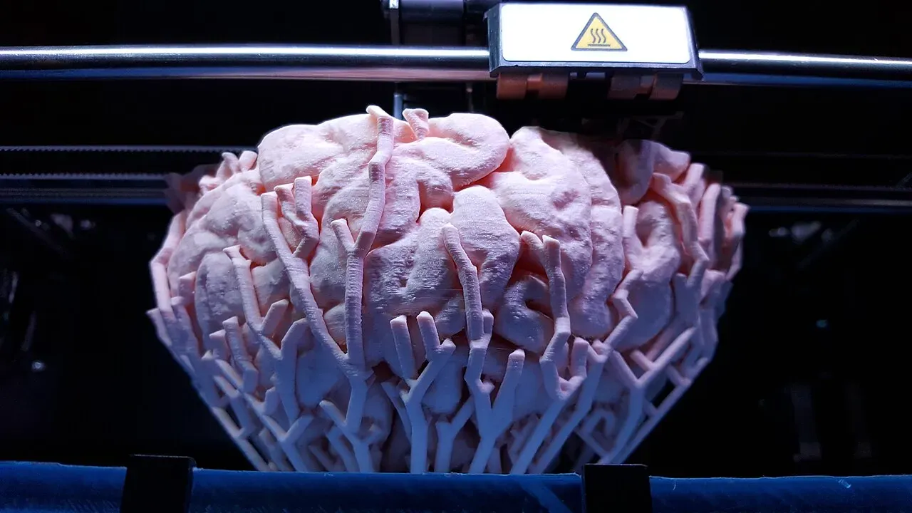 A brain model printed with tree-like support structures